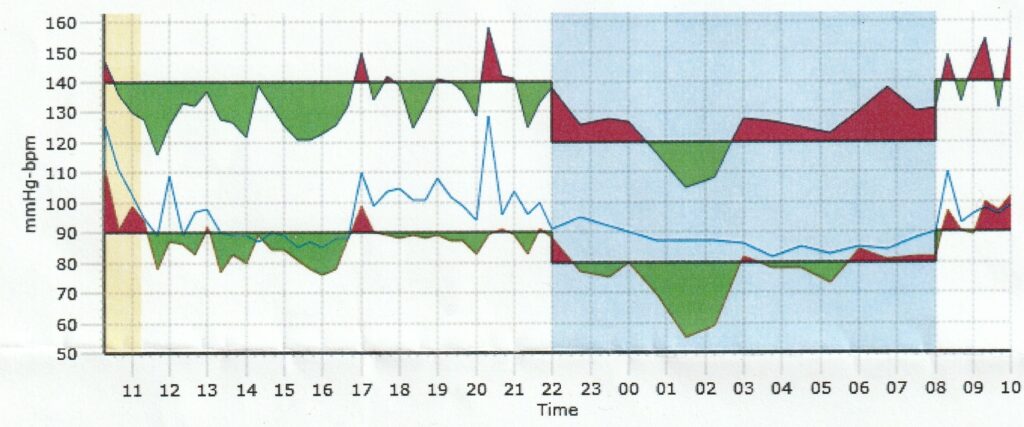 A graph showing my blood pressure and pulse over a 24 hours period